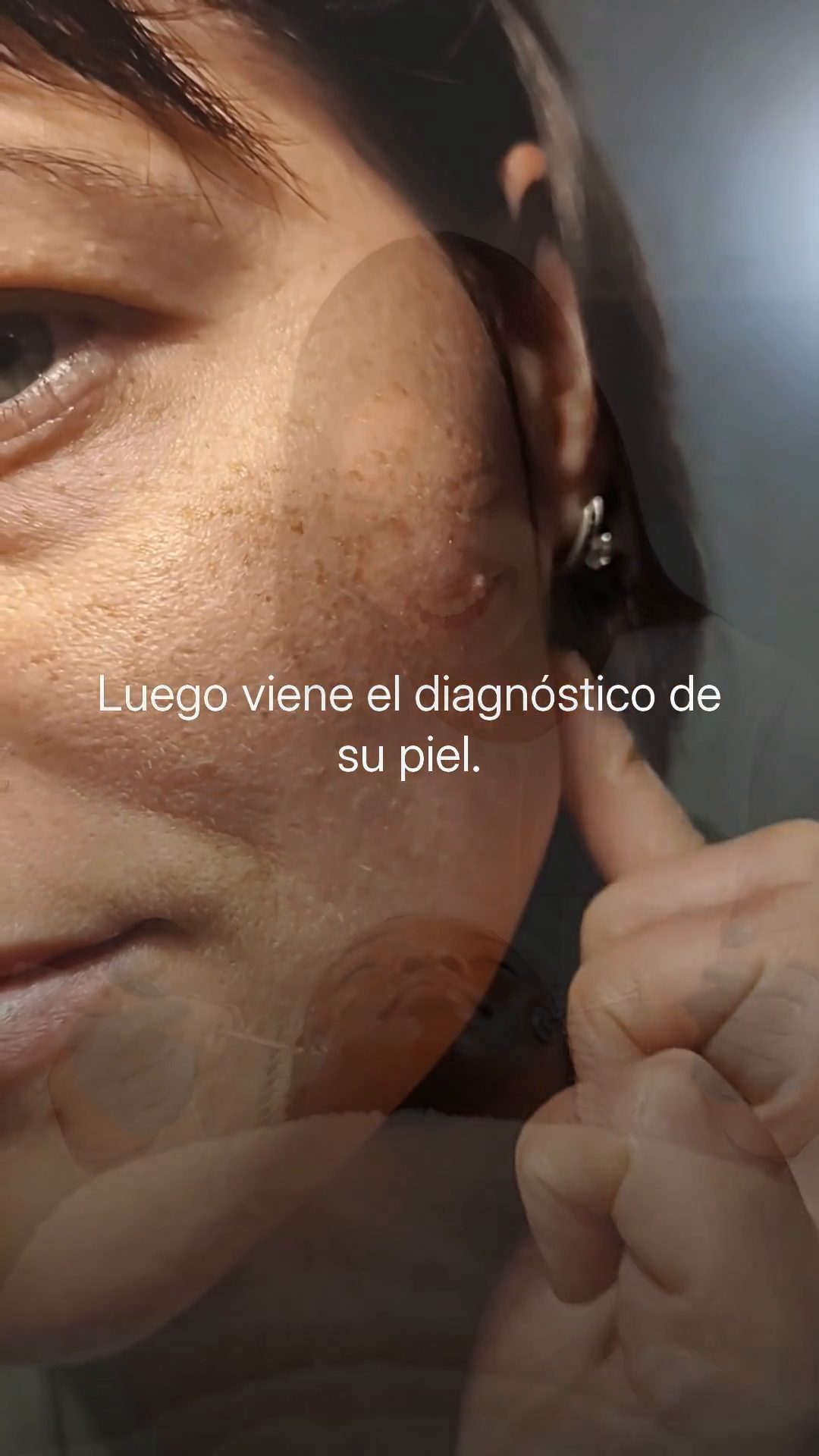 Fotograma de un reel de ejemplo para una clínica de estética: primer plano de la piel de una mujer con el rótulo «Luego viene el diagnóstico de su piel».